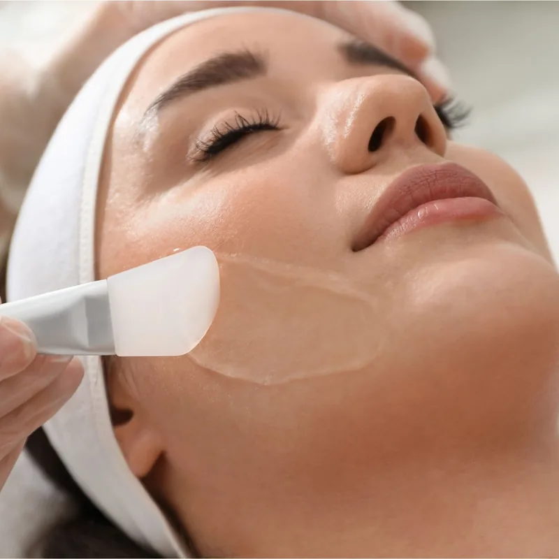 Kimyasal Peeling