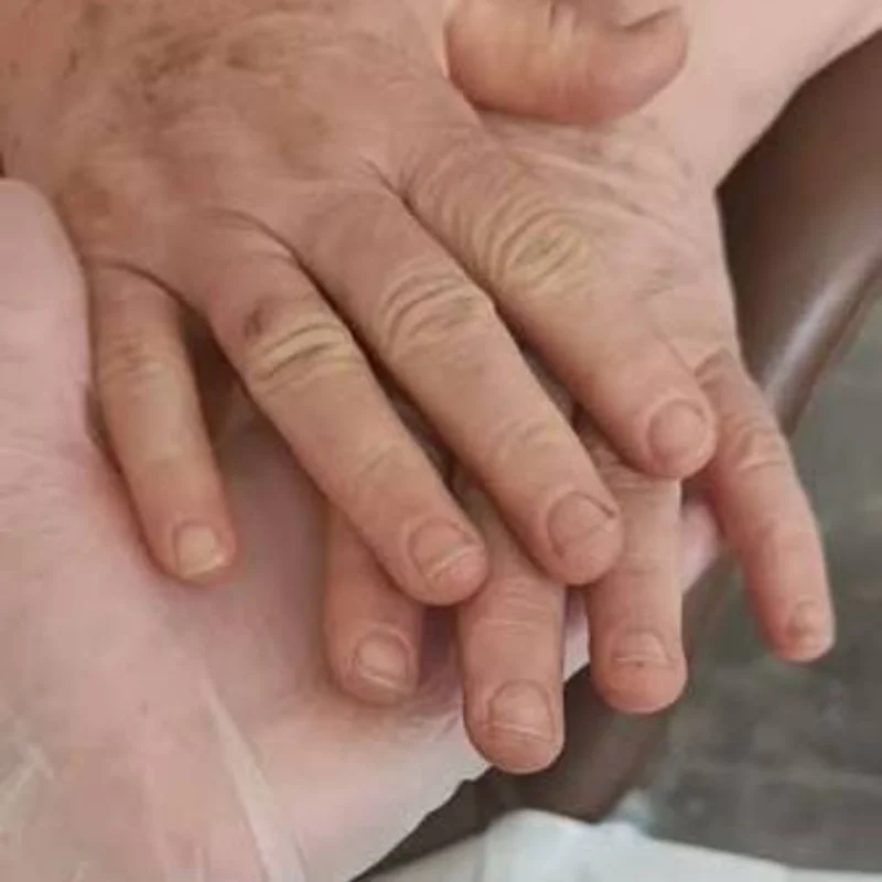 Parafin El ve Tırnak Bakımı