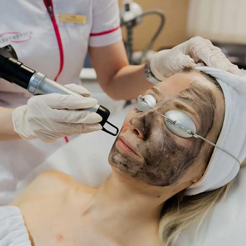 Anti-Aging Karbon Peeling