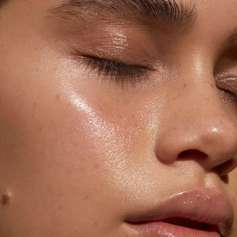 Akne Karşıtı HydraFacial