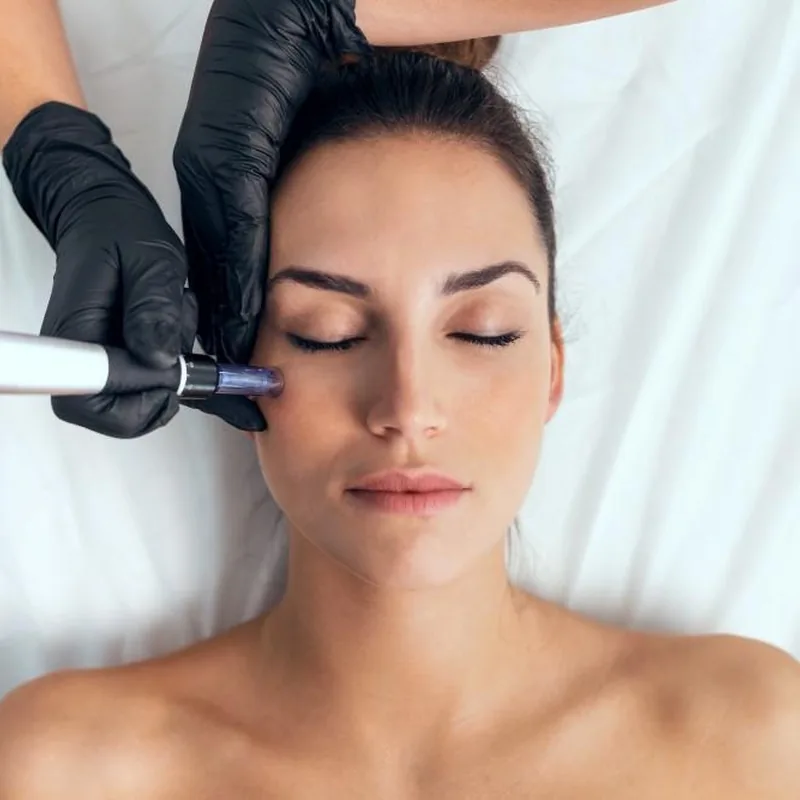 Anti-Aging Dermaroller